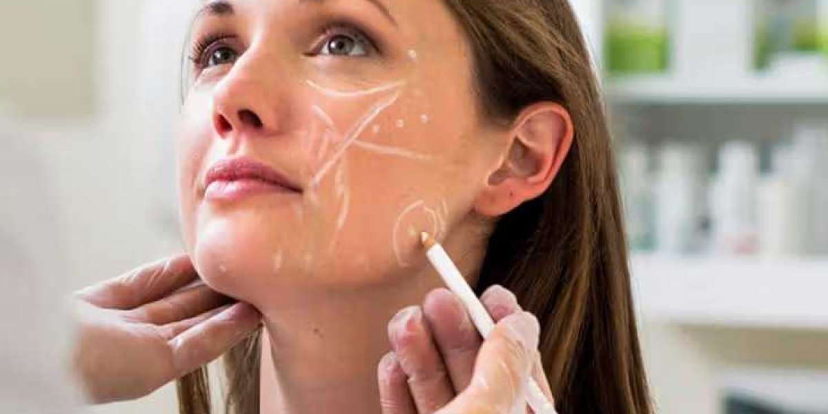 Collagen Fillers: The Complete Guide to Understanding Collagen Injections