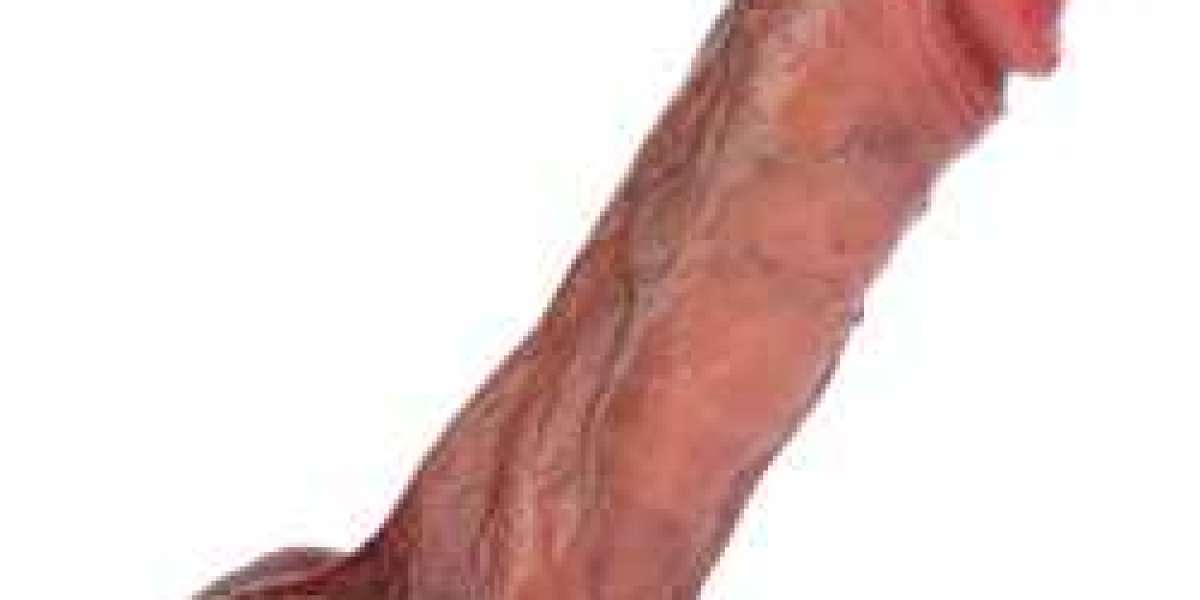 Article Picture